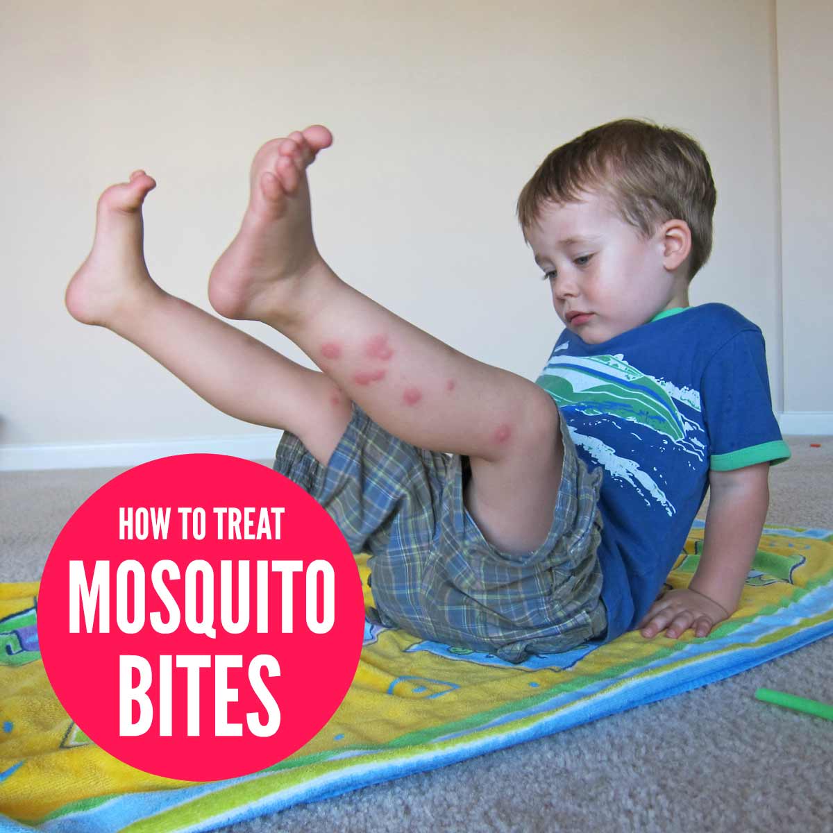 Treat mosquito bites naturally
