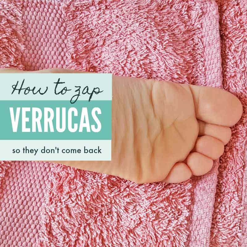 Get rid of verrucas so they don't come back #verrucas