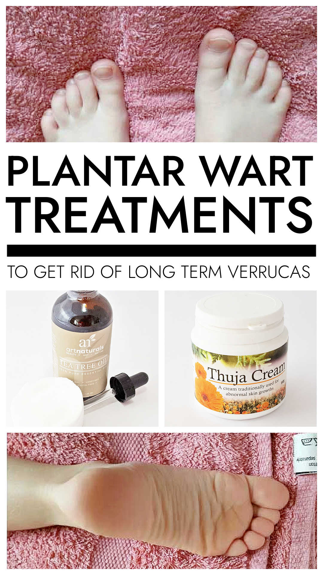 Get Rid Of Verrucas Naturally Get Rid Of Verrucas Naturally