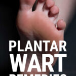 Sole of foot on dark background