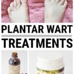 Collage of bare feet on pink towel and natural plantar wart treatments