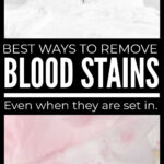 Best Ways To Remove Blood Stains