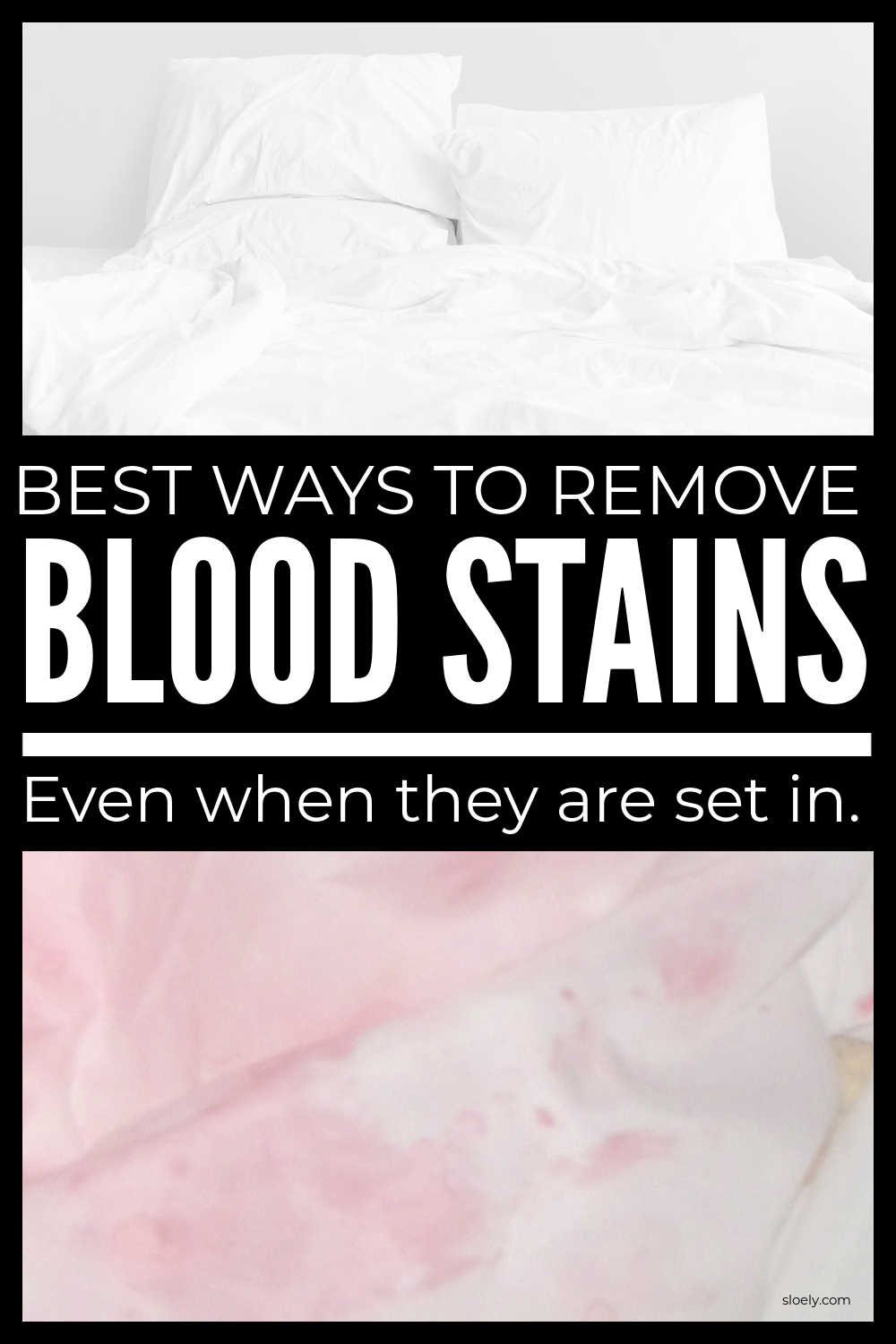 How To Remove Blood Stains Without Bleach