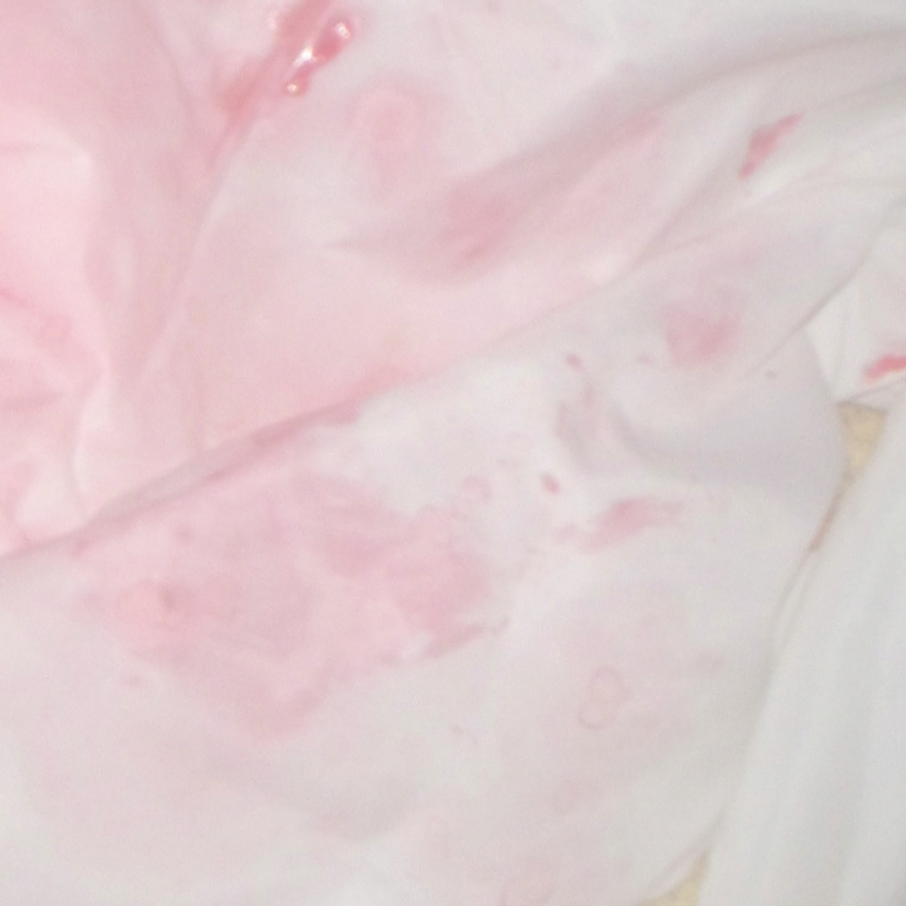 How To Remove Blood Stains Without Bleach