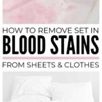 How To Remove Set In Blood Stains In Sheets & Clothes
