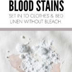 How To Remove Set In Blood Stains