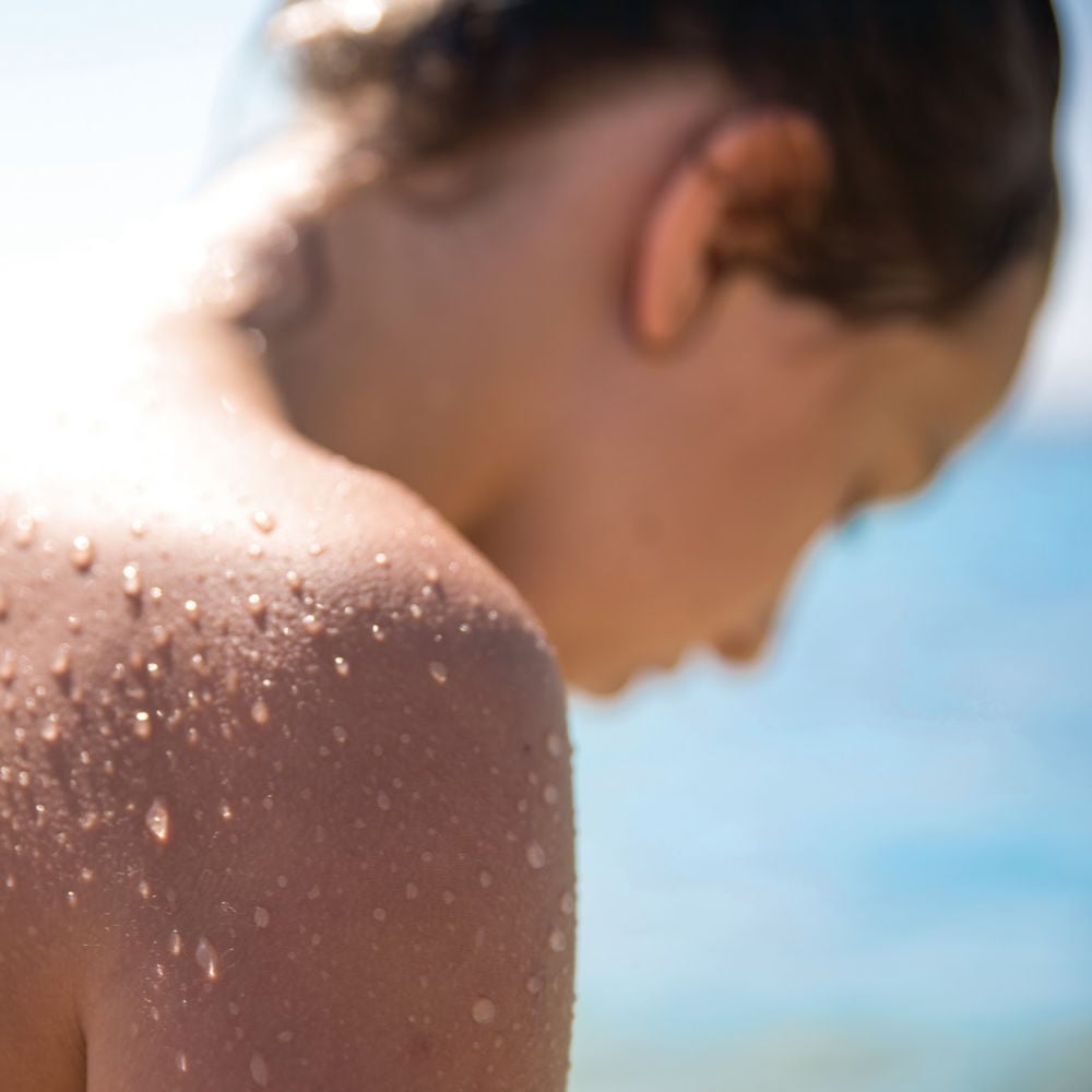 Best Quick Sunburn Remedies and Natural Sunburn Relief