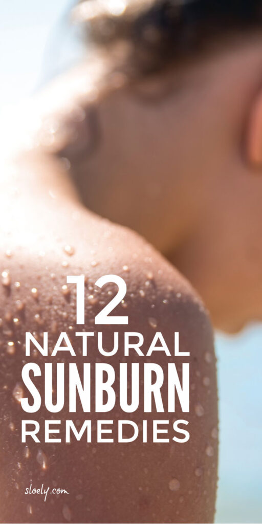 Natural Sunburn Remedies & Relief