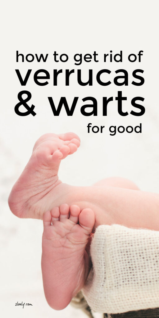 Get Rid Of Verrucas & Warts For Good
