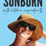 How To Heal Sunburn