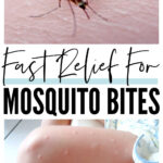 Mosquito Bite Relief