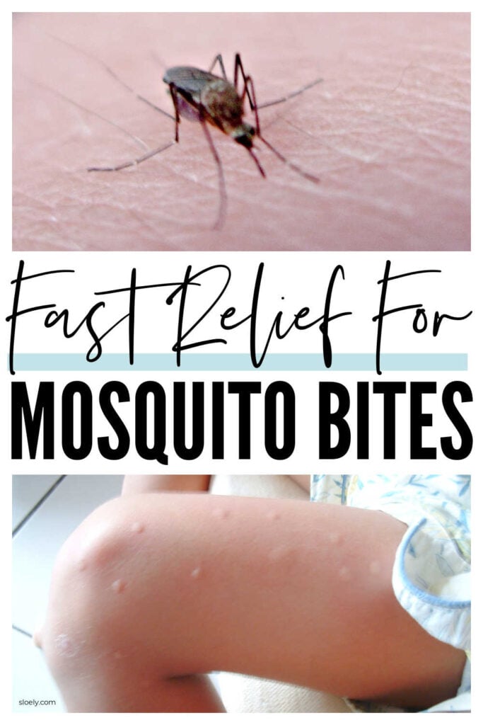 Mosquito Bite Relief