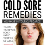 Super Quick DIY Cold Sore Remedies