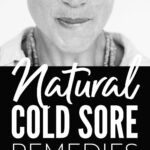 Natural Cold Sore Remedies