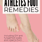 Athlete's Foot Remedies Including DIY Soaks
