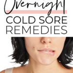 Overnight Cold Sore Remedies