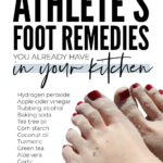 DIY Remedies For Athletes Foot