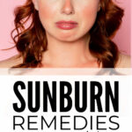 DIY Sunburn Remedies For Quick Relief