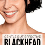 Gentle Blackhead Removal Treatments
