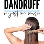 How To Get Rid Of Dandruff In One Wash