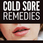 Fast Effective Cold Sore Remedies
