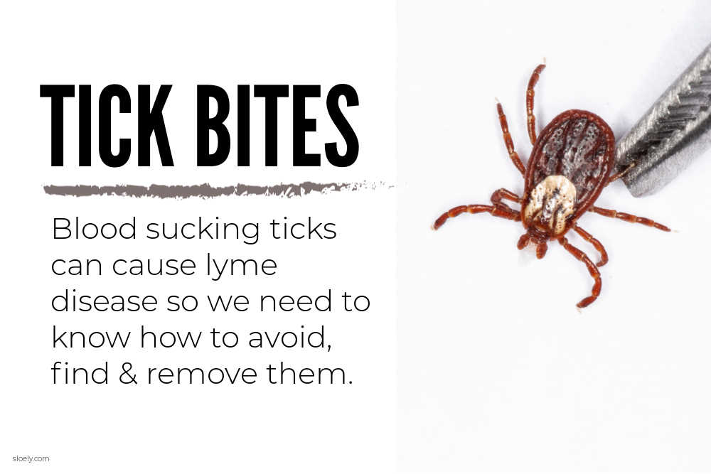 How To Avoid, Repel, Find And Remove Ticks