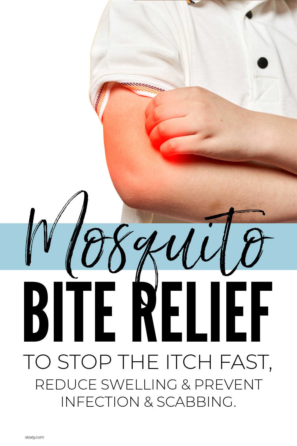Mosquito Bite Remedies