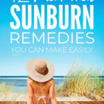 Natural Sunburn Remedies