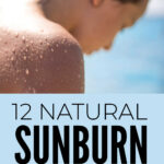 Natural Sunburn Relief