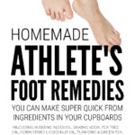 Athletes Foot Home Remedies