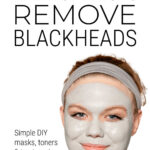 Blackhead Removal Treatments