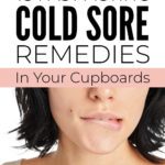Fast Acting DIY Cold Sore Remedies