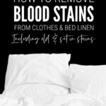 How To Remove Blood Stains From Clothes And Bed Linen