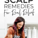 Itchy Scalp Remedies And Treatments