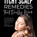 Dry Itchy Scalp Remedies