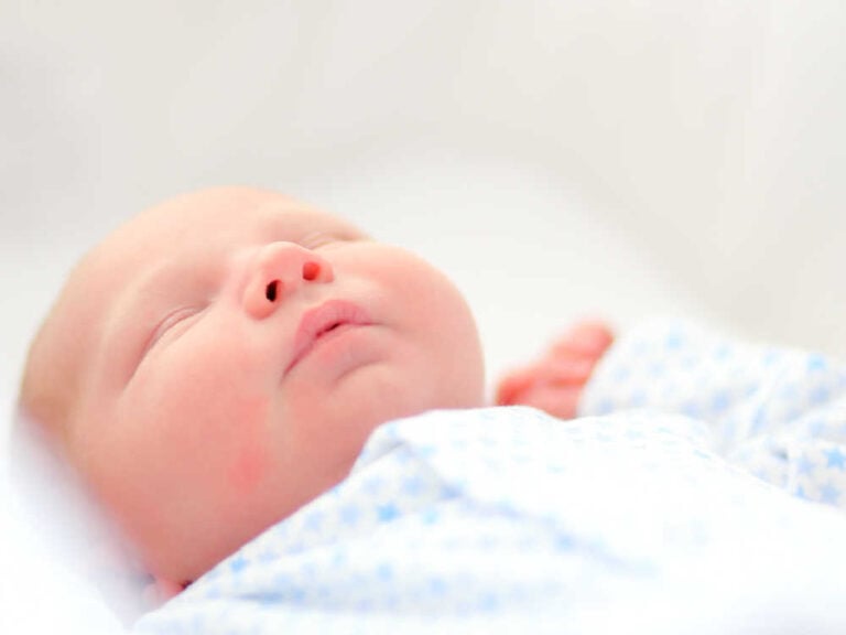 Baby Reflux Remedies