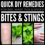 DIY Remedies For Bites And Stings From Wasps, Bees, Ticks And Spiders