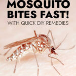 Best Ways To Treat Mosquito Bites Fast