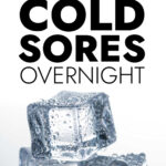 Get Rid Of Cold Sores Overnight