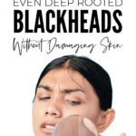 How To Remove Deep Rooted Blackheads Without Damaging Skin