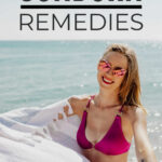 Sunburn Remedies For Instant DIY Relief