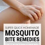 Woman scratching mosquito bite on her leg