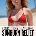 Young sunburned woman wearing a red bikini