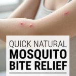 Woman's arm with mosquito bites