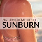 Woman with sunburn on the beach