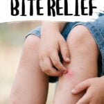 Child scratching mosquito bite on legs