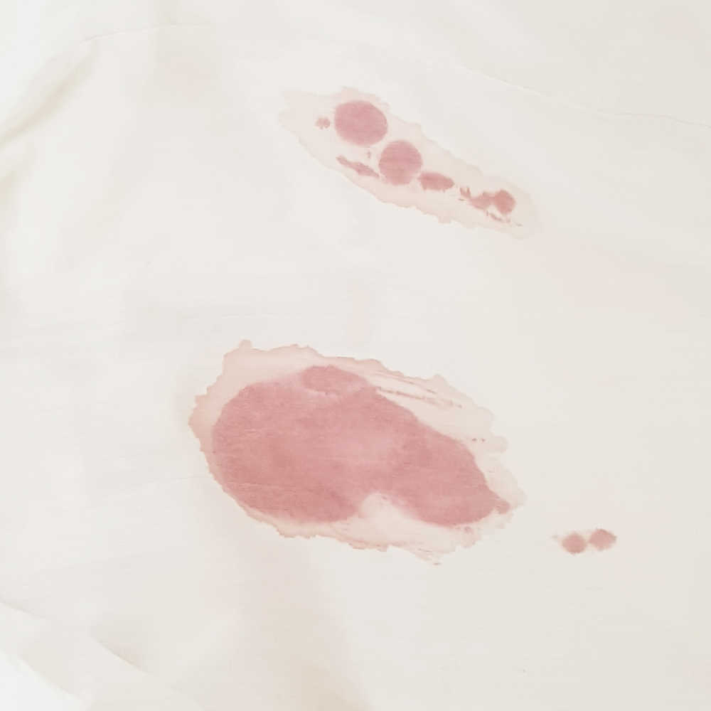 How To Remove Fresh Blood Stains Without Chlorine Bleach